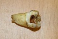John Lennon's tooth