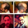 AJ McLean